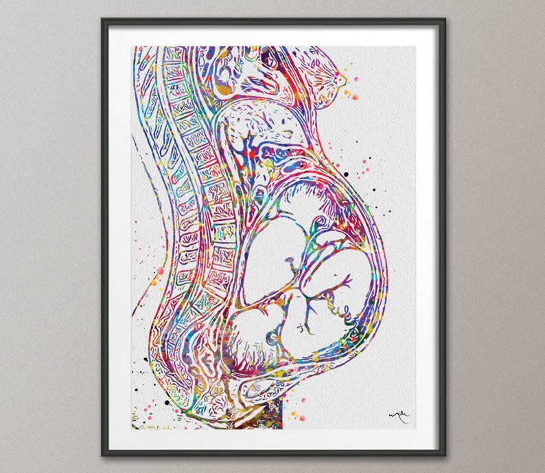 Twin Pregnancy Watercolor Print Womb Pregnancy Anatomy image 0