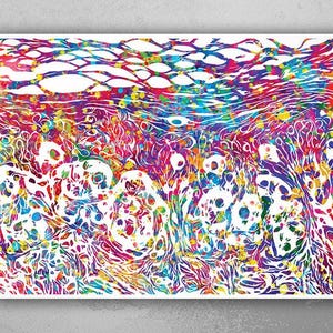 Skin Melanoma Histology Watercolor Print Medical Art Science Art Integumentary Epidermis Histology Biology Art Skin Skin Cancer Poster-1198