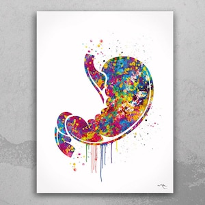 Stomach Watercolor Print Human Organs Gastrointestinal Clinic Decor stomach cancer Gastroenterology Medical Art Gastroenterologist Gift-1031