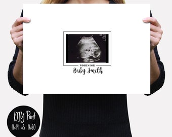 Tiny Ideas Sonogram Signature Frame guest Book, Ultrasound Picture