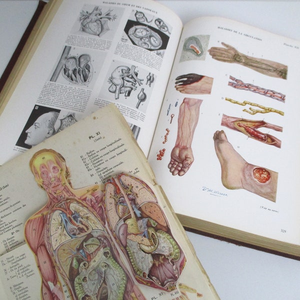 Vintage Medical Book With Anatomy Supplement - French Language - Le Guide Medical Du Foyer - Household Medical Guide - Anatomy Illustrations