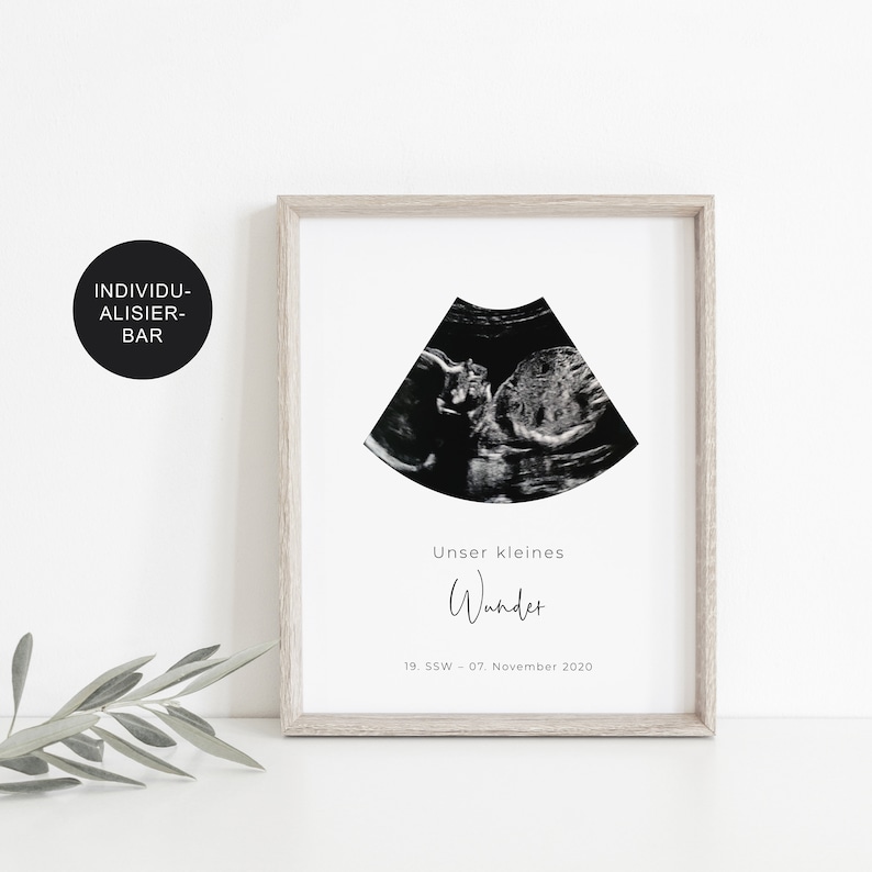 Poster ultrasound image personalized announce pregnancy baby room decoration little miracle baby image 4