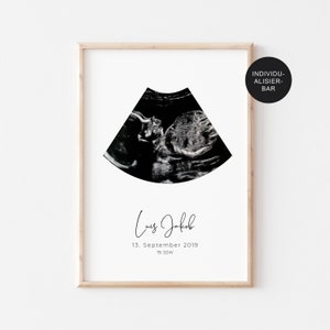 Poster ultrasound image personalized dates of birth - announce pregnancy as a gift - birth chart reminder of a small miracle