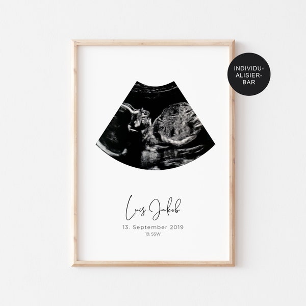 Poster Ultraschallbild personalisiert Geburtsdaten – Schwangerschaft verkünden als Geschenk – Geburtstafel Erinnerung kleines Wunder