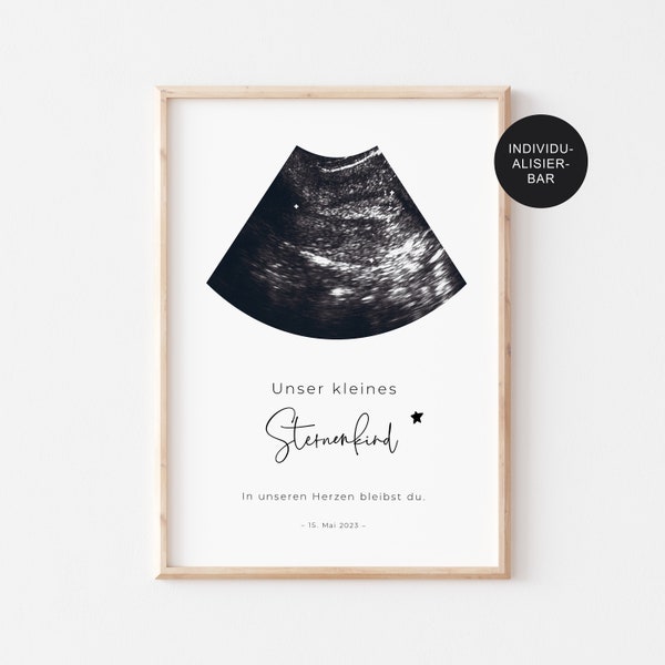 Sternenkind Erinnerung Poster mit Ultraschallbild personalisiert – Andenken Fehlgeburt – Verlust Baby – Totgeburt