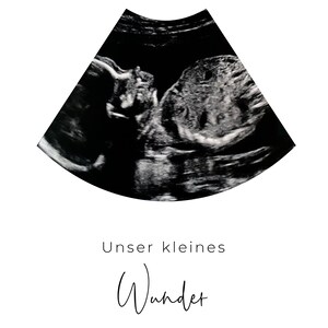Poster ultrasound image personalized announce pregnancy baby room decoration little miracle baby image 5