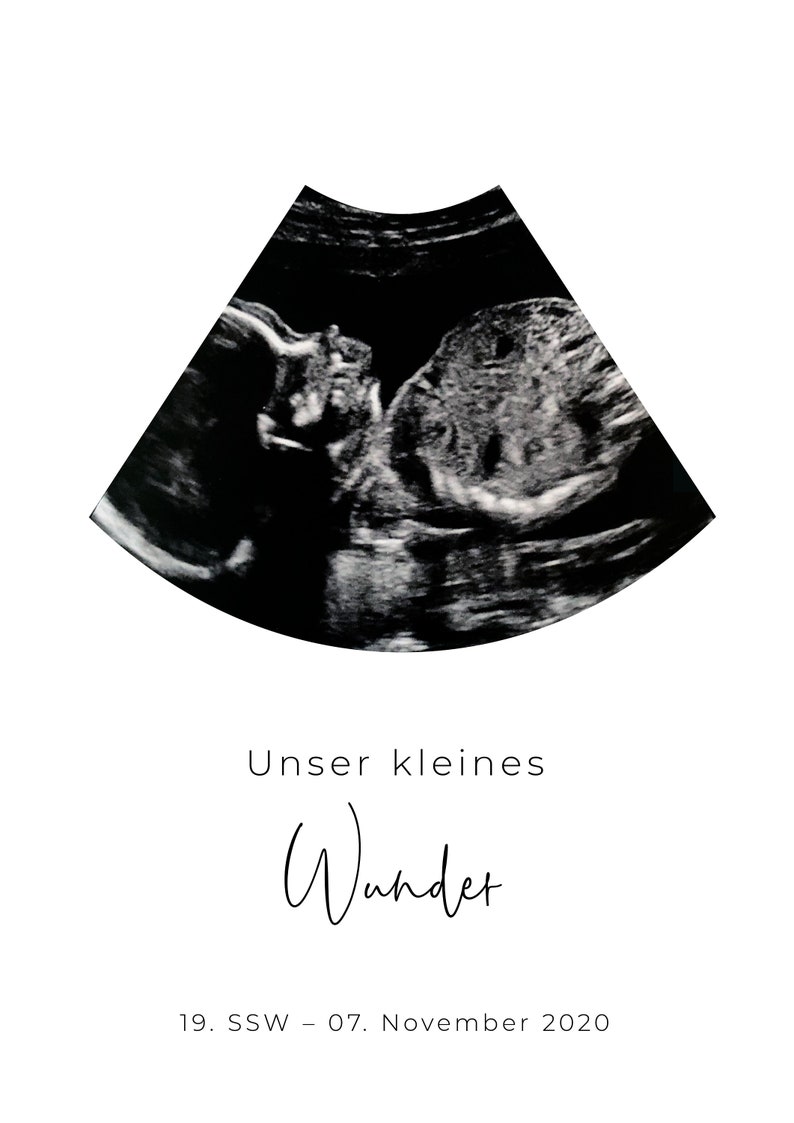 Poster ultrasound image personalized announce pregnancy baby room decoration little miracle baby image 5