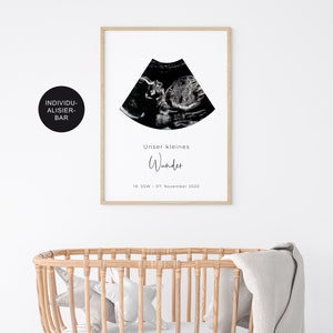 Poster ultrasound image personalized announce pregnancy baby room decoration little miracle baby image 2