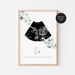 Poster Ultraschallbild personalisiert "Eukalyptus" – Schwangerschaft verkünden – Geschenk – Poster – Kleines Wunder – Baby