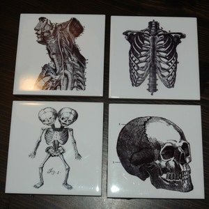 Vintage Anatomy Ceramic Printed Coaster Set of 4 ~ Dark Decor