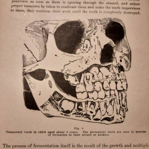 Anatomical Illustration,  Child's Teeth