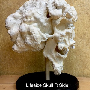 Joseph Merrick, The Elephant Man life-size skull reproduction image 3