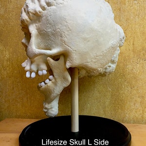 Joseph Merrick, The Elephant Man life-size skull reproduction image 2