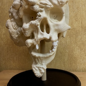 Joseph Merrick, The Elephant Man life-size skull reproduction image 1