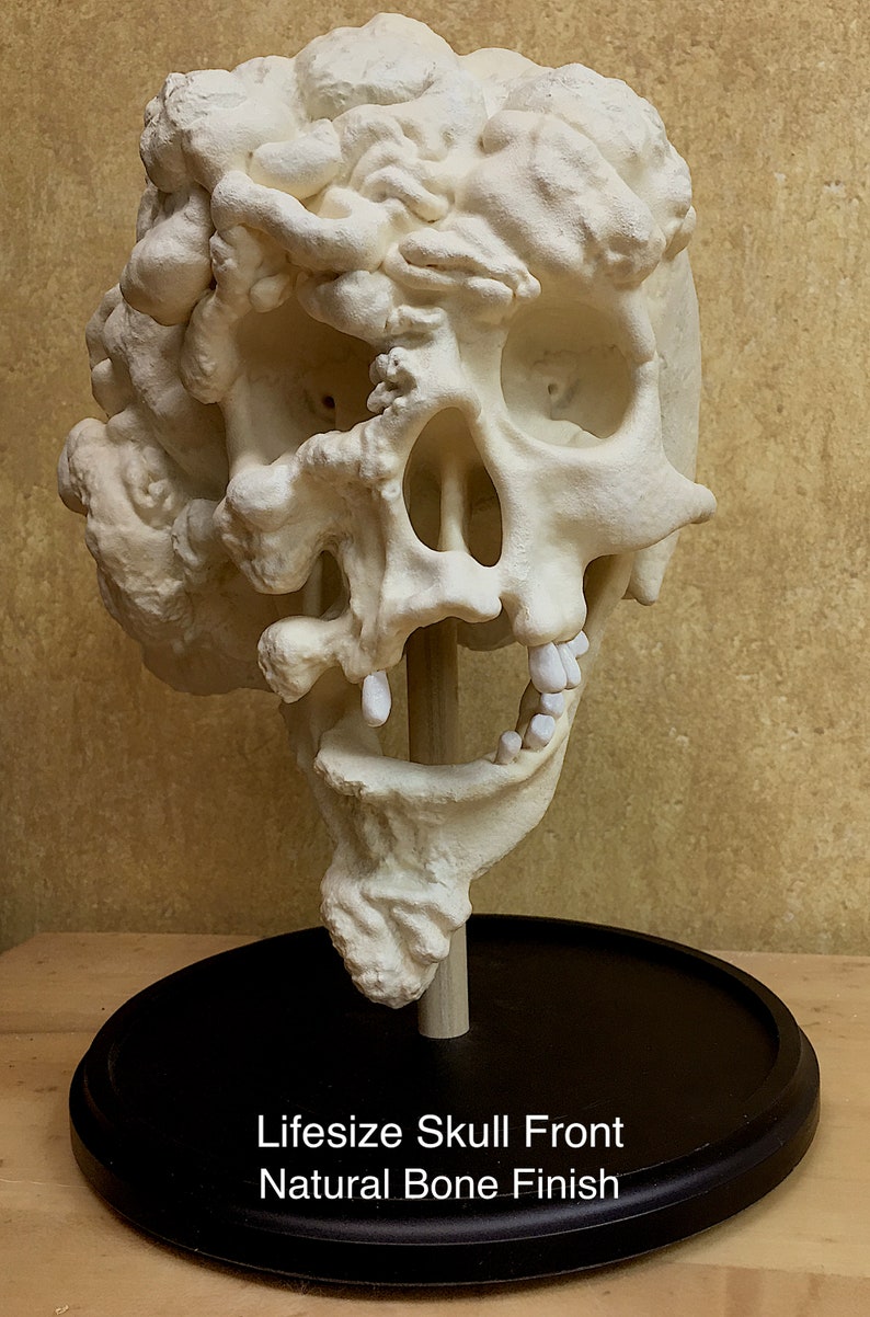 Joseph Merrick, The Elephant Man life-size skull reproduction image 1