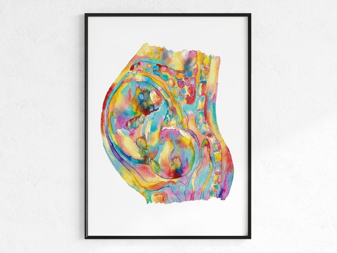 Pregnancy Art Print Woman With Child Watercolor Pregnant Woman Medical ...
