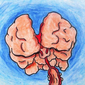 Gebrochenes Gehirn #581 (ARTIST TRADING CARDS) 2,5" x 3,5" Mkek Kraus - Aceo Demenz Azheimer Demenz kognitiv Schlaganfall Emotionen Erinnerung Gesundheit