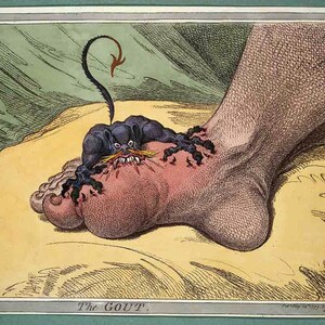 Gout, A 1799 Caricature By James Gillray Alcohol Alcoholism. Print/Poster (4865)