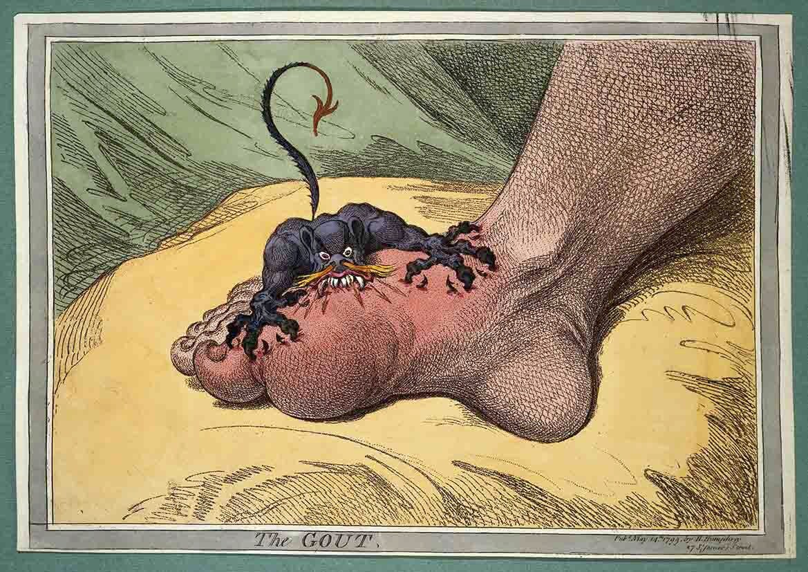 Gout, A 1799 Caricature By James Gillray Alcohol Alcoholism. Print/Poster (4865)
