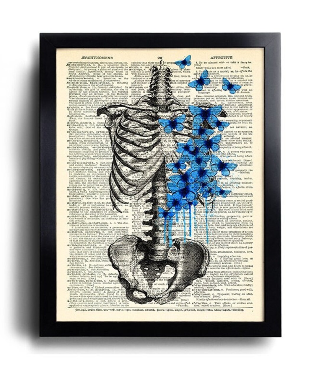 Ribcage Print Ribcage Blue Butterfly Poster Ribcage Art Human Anatomy
