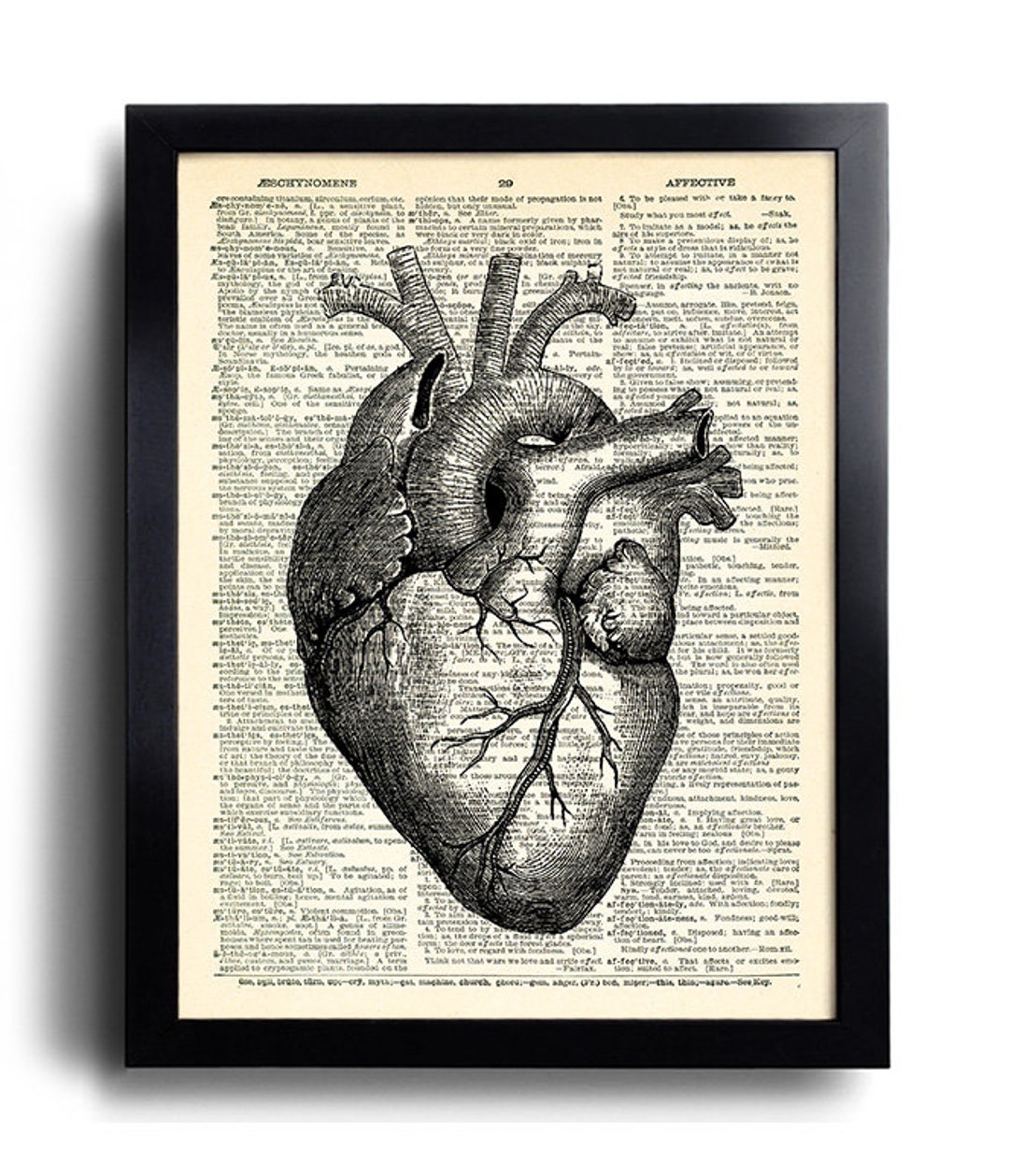 Buy Heart Human Anatomy Art Print ANNIVERSARY Gift Man Boyfriend Gift,  Anatomical Heart, ENGAGEMENT Gift Him Husband, Cool Anatomy Heart 254  Online in