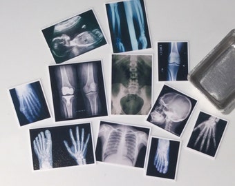 X-rays, Photos, Dollhouse Miniature, 1/12 scale - 1 inch, medical, anatomy, surgery, medical, Doctors, bones, Study, Detective