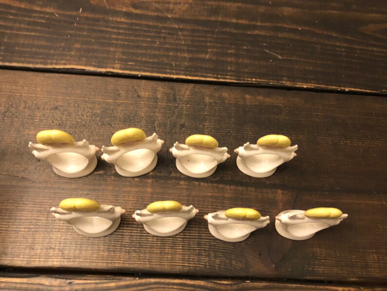 Puede incluir: Ocho anillos de servilleta de cer&aacute;mica con un esmalte amarillo. Cada anillo tiene forma de concha con un dise&ntilde;o en relieve.