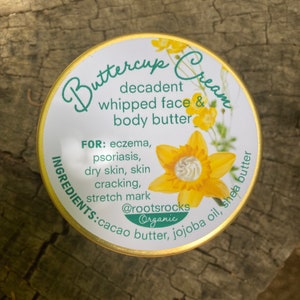 Buttercup Cream: a decadent whipped face & body butter. Healing for eczema, psoriasis, dry cracked skin, stretch mark prevention with cocoa image 2