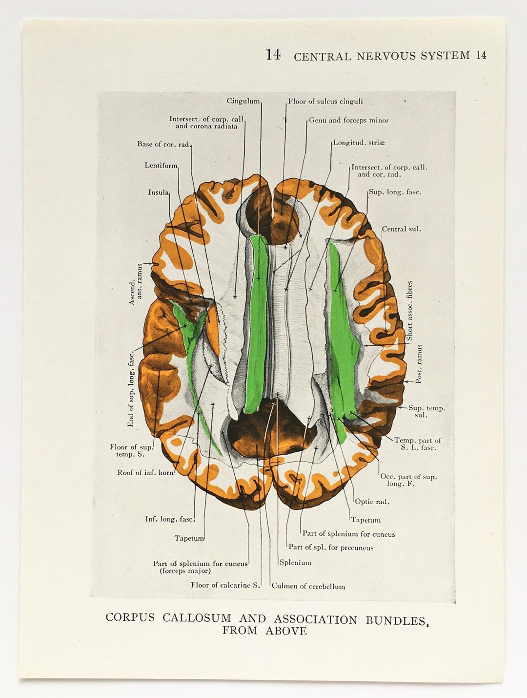 BRAIN ANATOMY 1930s Vintage Print, Central Nervous System, Colour ...