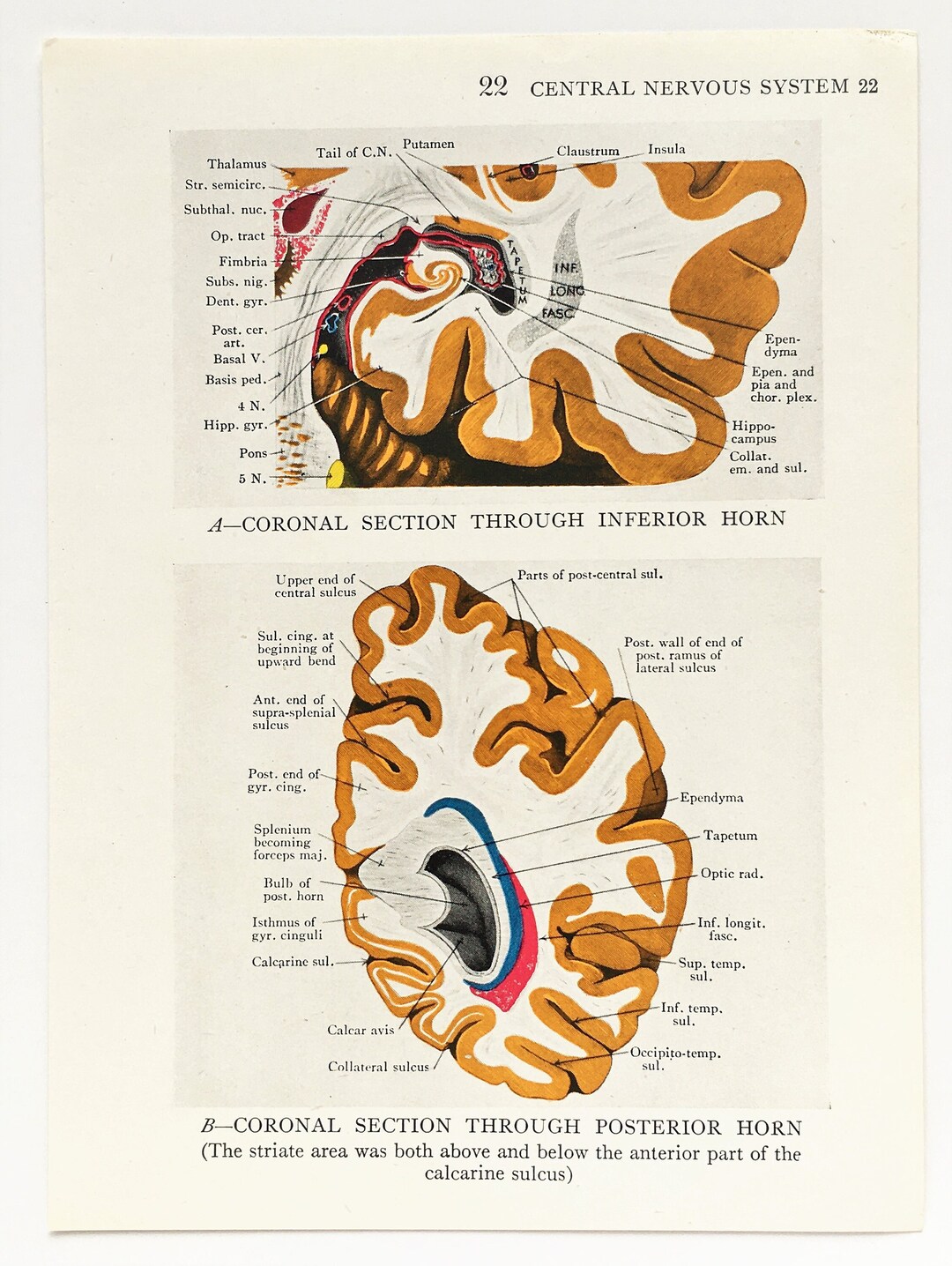 BRAIN ANATOMY 1930s Vintage Print, Central Nervous System, Colour ...