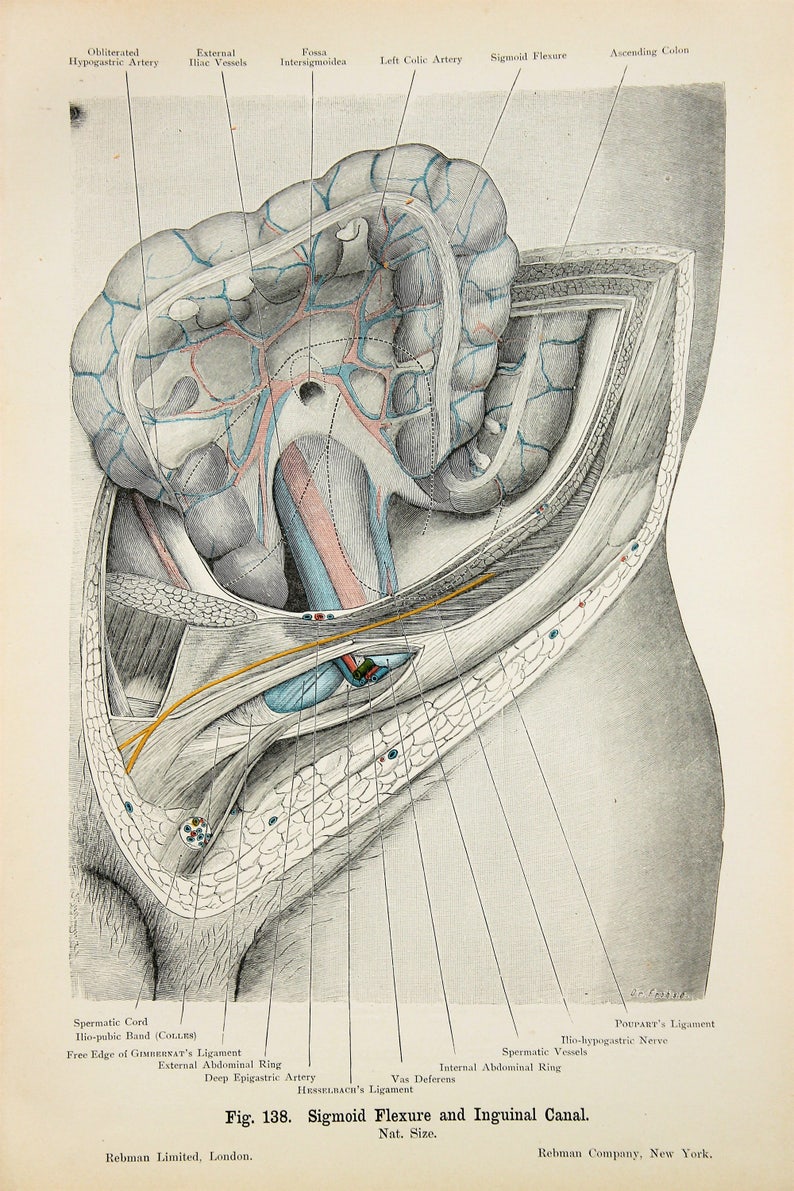 Abdomen Intestines Arteries Veins Nerves Cross Section Etsy