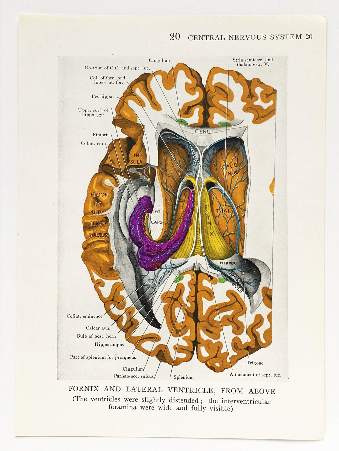 BRAIN ANATOMY 1930s Vintage Print, Central Nervous System, Colour ...