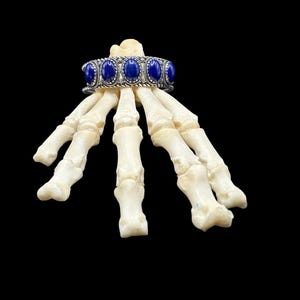 May include: A silver bracelet with oval, deep blue gemstones is displayed on a skeletal hand against a black background. The bracelet's setting has a detailed, rope-like design. The bones are off-white, creating a stark contrast with the dark backdrop and the bracelet.