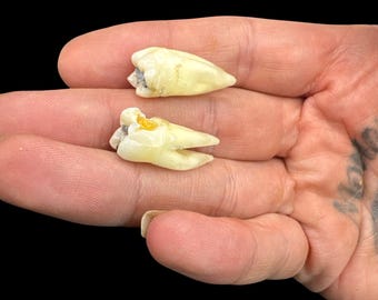 Par real de molares humanos Molares humanos grandes Dientes humanos Hueso Dientes