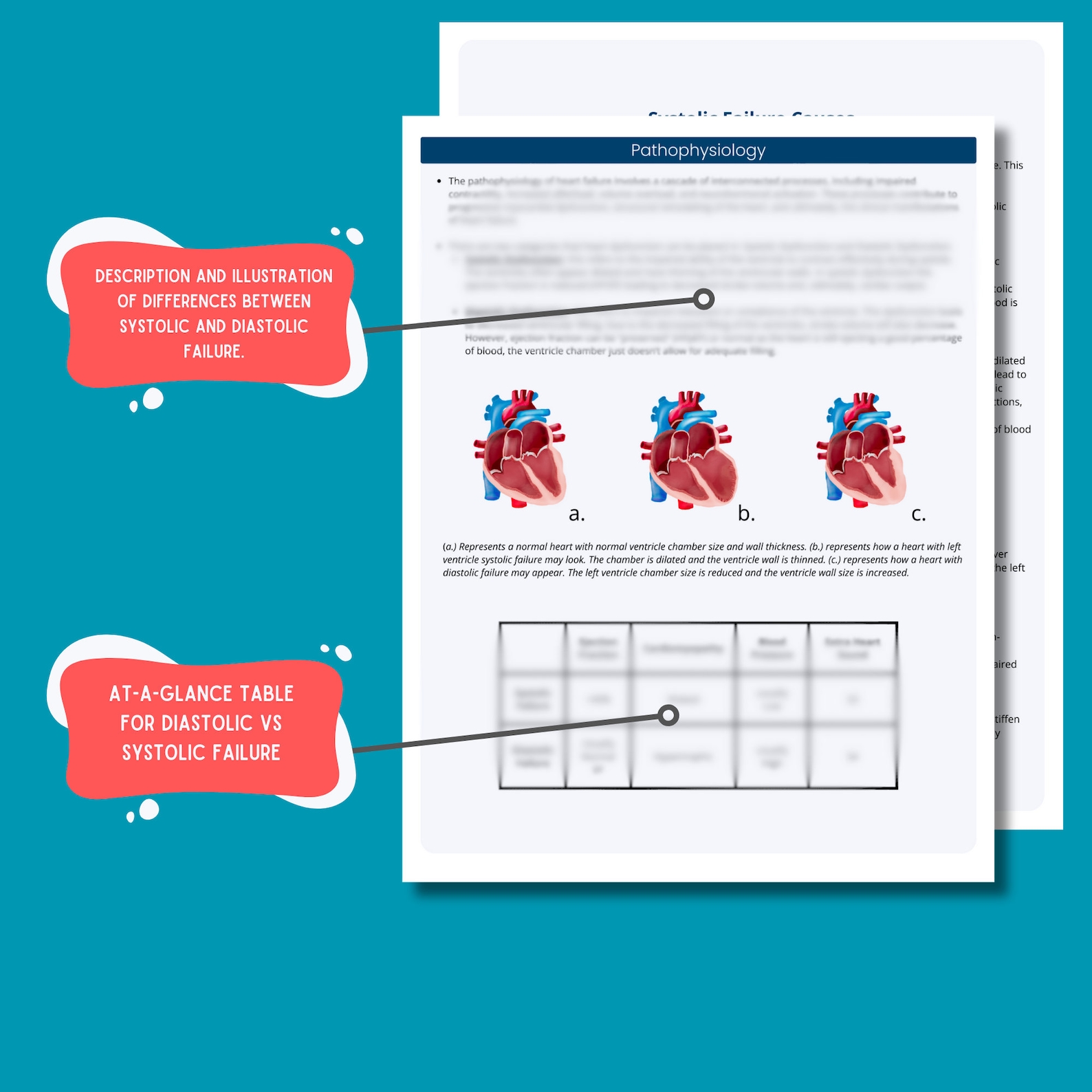 Heart Failure Nursing Notes: ICU Cardiac Study Guide (digital Download ...