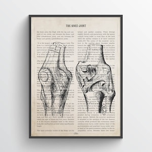 Knee Joint Anatomy Print, Gift for Orthopedic surgeon, Orthopedists Decor,  Ortho Docs Medical Student Graduation Wall Art,