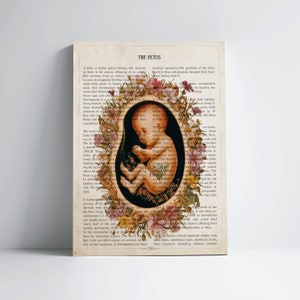 Fetus in Womb Flower Anatomy Print, Obstetrician Graduation Gift Idea, Doctor Office Print, Gynecologist Art, Embryo Print, Pregnancy Gift