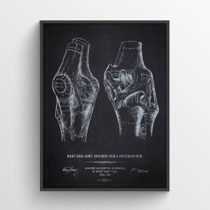 Knee Joint Anatomy Print, Gift for Orthopedic surgeon, Orthopedists Decor, Ortho Docs Medical Student Graduation Wall Art, Decor for Clinics