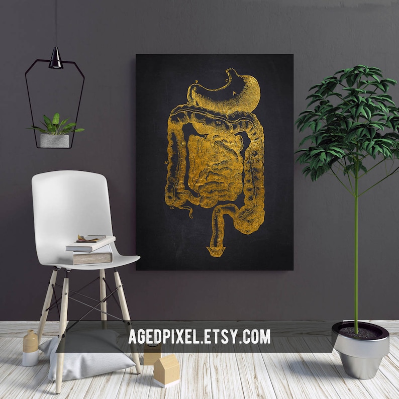Digestive Tract Anatomy Print, Intestine, Stomach Art, Medical Office ...