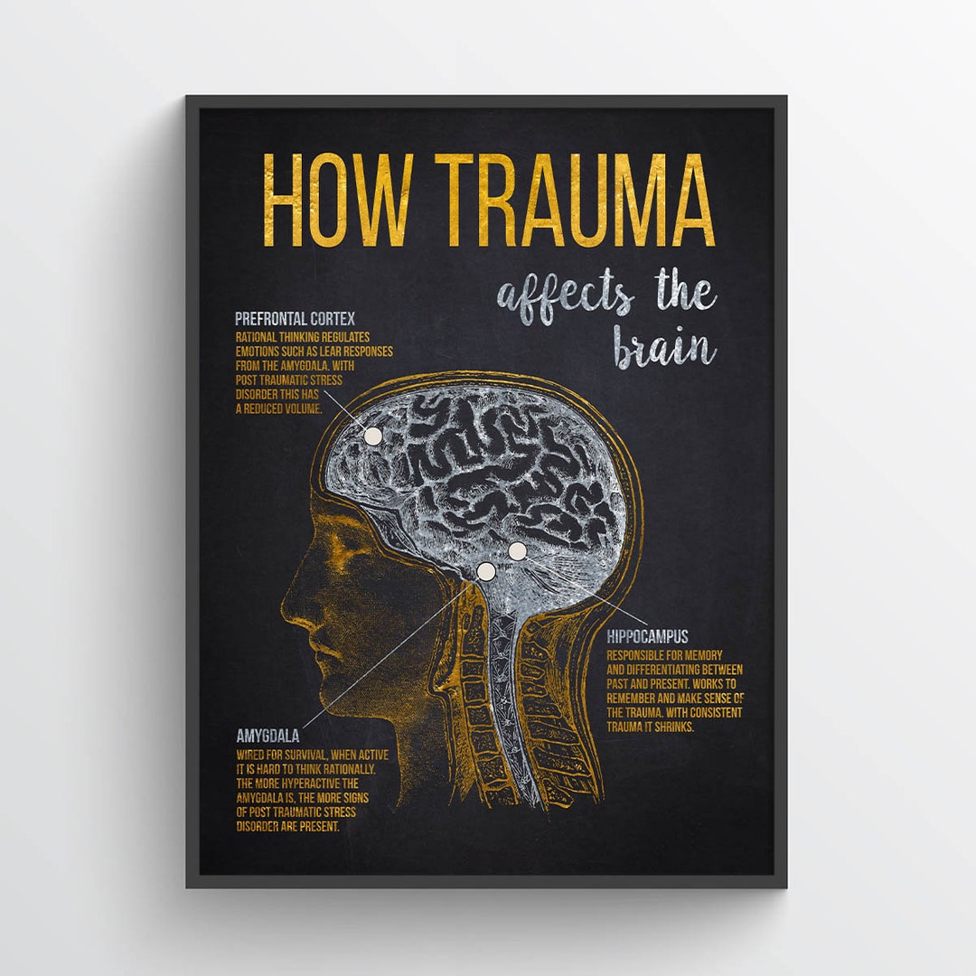 How Trauma Affects the Brain Print, Brain Anatomy, Psychology Poster ...