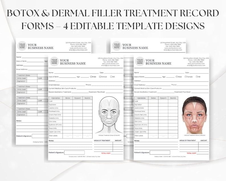 Botox Treatment Sheet, Editable Consent Form for Medspa, Aesthetic ...