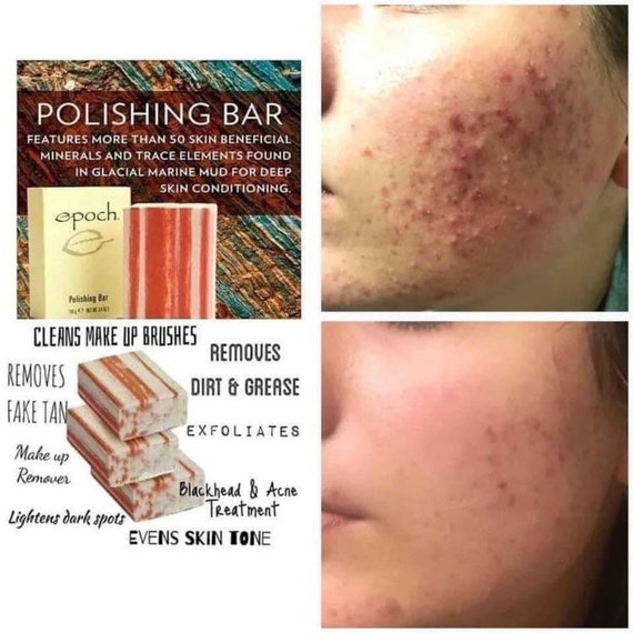 Epoch soap deals