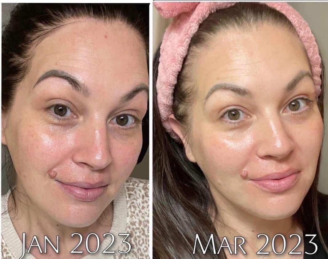 Vitamin C Collagen Pump Etsy