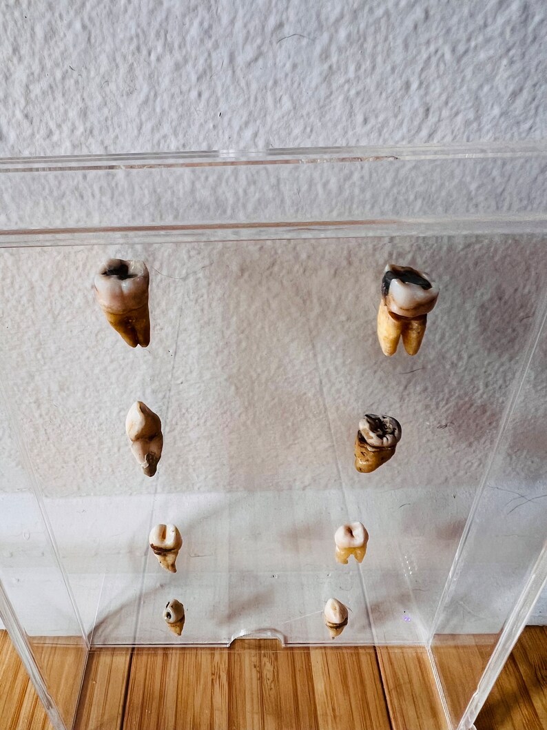 Real Human Teeth Acrylic Shadow Box Display Human Tooth - Etsy