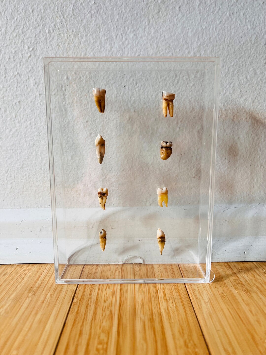 Real Human Teeth Acrylic Shadow Box Display Human Tooth - Etsy