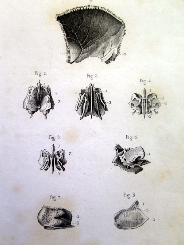 Antique Print Of Anatomy 1846 , Cranial Section Engraving , Vintage ...