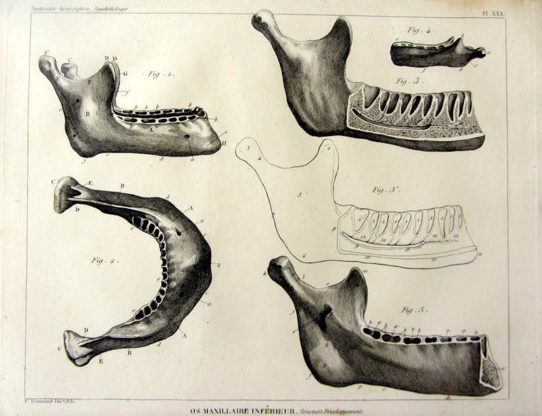 Antique Dental Inferior Maxilla Anatomy Engraving, Print of Human Body ...