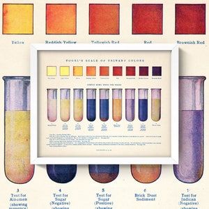 May include: A vintage medical chart showing Vogel's Scale of Urinary Colors with a color chart of urine colors and test tubes showing simple home tests for urine. The tests include tests for albumin, sugar, and indican.