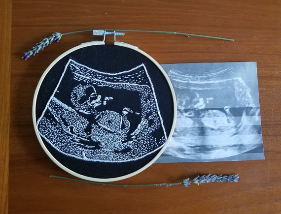 Custom hand embroider ultrasound Custom sonogram embroidery Personalized Embroidered ultrasound. Custom ultrasound embroidery