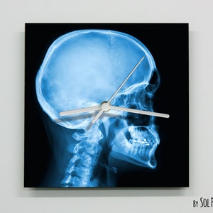 May include: A blue and white clock with a skull x-ray image as the background. The clock hands are silver and the clock face is black. The text "By SOL PIXIE DUST" is at the bottom of the clock.